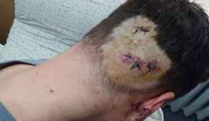 Избитый в Харькове активист Булах связывает нападение с общественной деятельностью