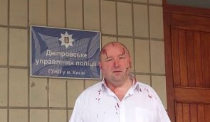 У Києві побили правозахисника Дядюка, який бореться із незаконними забудовами