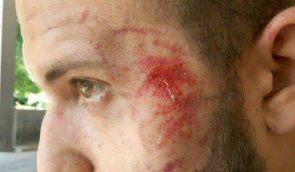 Unknown masked men beat up Hromadske TV journalist in Zaporizhzhia