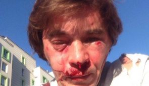 Під Києвом побили активіста, який бореться проти забудови парку у Вишневому