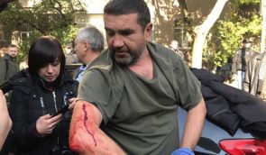 Під час акції під МВС напали на журналістку, одного з активістів поранили