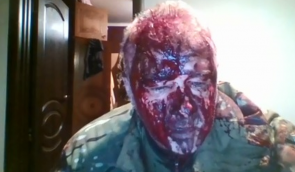 “Ах ти, с*ка, воїн”: на Одещині жорстоко побили ветерана-активіста, нападників відпустили