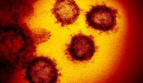 Правозахисники занепокоєні низьким діагностуванням коронавірусу в Криму