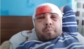 Поліція не встановила нападника на активіста Філатова в Кам’янському, але перекваліфікувала злочин на тяжчий