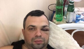 Cуд починає розгляд справи про напад на адвоката Миколу Неділька