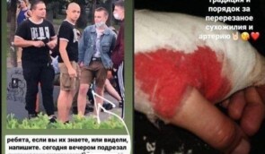 На київському Подолі праворадикали порізали підлітку руку через нашивку з пентаграмою
