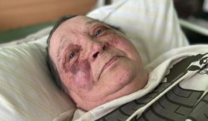 70-річній волонтерці з Херсону військові РФ зламали хребет за відмову віддати український паспорт