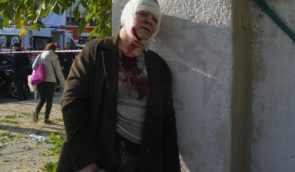 В больницах Киева до сих пор находятся 35 пострадавших в результате ракетных ударов 10 октября