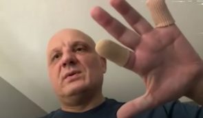 “У мене руки почали гнити”: після російського полону житель Київщини втратив пальці та частину стопи