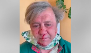 Российский военный Егор Гузенко обнародовал видео с пытками украинского гражданского