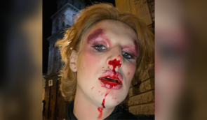 У центрі Львова невідомий побив трансгендерну військову Хелен Марк