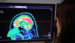 На Житомирщині дослідження мозку почали проводити із застосуванням штучного інтелекту
