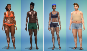 У The Sims 4 тепер можна створювати персонажів з вітиліго