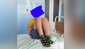 У Києві школярі побили 13-річного однолітка: хлопцю зробили операцію, справу розслідує поліція