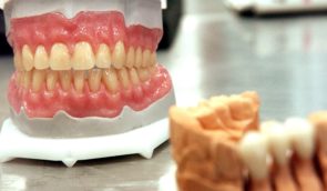 Військові та ветерани можуть безоплатно протезувати зуби в майже пів сотні медзакладів: як отримати допомогу?