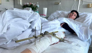 Стан журналістки Укрінформу Ольги Звонарьової, яка отримала поранення під час обстрілу Запоріжжя, стабілізувався