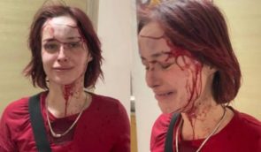 Побиття дівчини в Одесі: у командуванні “Південь” публікацію відео назвали “роботою на ворога”