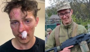 У Києві молодик побив ветерана за “неправильну” зачіску