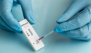 За тиждень в Україні зафіксували понад 3,5 тисячі випадків COVID-19 – ЦГЗ