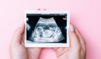 Шотландія розглядає можливість дозволити аборти на підставі статі плода