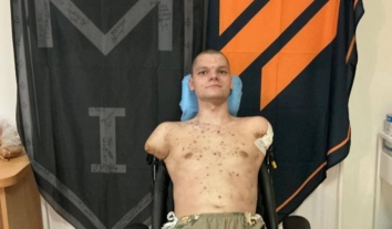 Ветерану з ампутаціями не могли видати картку у банку через правила фінмоніторингу: після розголосу їх обіцяють змінити