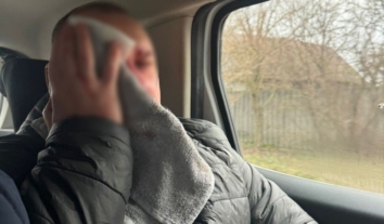 Унаслідок ударів російських військ по Сумщині постраждали четверо людей, серед них – дитина