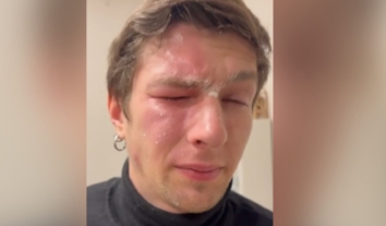 У Львові сусідка розпилила газовий балончик в обличчя ветерану, який пережив російський полон