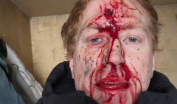 Волонтера Дениса Христова поранено, він потрапив під обстріл російських дронів під Куп’янськом