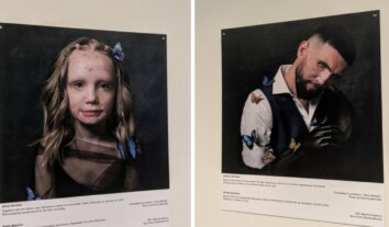 “Кокон життя”: у Європарламенті представили виставку портретів цивільних і військових, які після поранень через російську агресію пройшли пластичні операції “Кокон життя”: у Європарламенті представили виставку портретів цивільних і військових, які після поранень через російську агресію пройшли пластичні операції