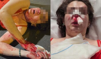 У Парижі дві російськомовні дівчини напали на українок, постраждалі кажуть – на ґрунті ненависті У Парижі дві російськомовні дівчини напали на українок, постраждалі кажуть – на ґрунті ненависті