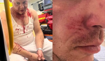У польському Кожухуві сталася бійка між українцями та поляками: поліція не бачить національного мотиву У польському Кожухуві сталася бійка між українцями та поляками: поліція не бачить національного мотиву