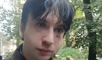 “Вимагали вибачитися за ліві погляди й виїхати зі Львова”: активіст Владислав Стародубцев розповів про напад “Вимагали вибачитися за ліві погляди й виїхати зі Львова”: активіст Владислав Стародубцев розповів про напад
